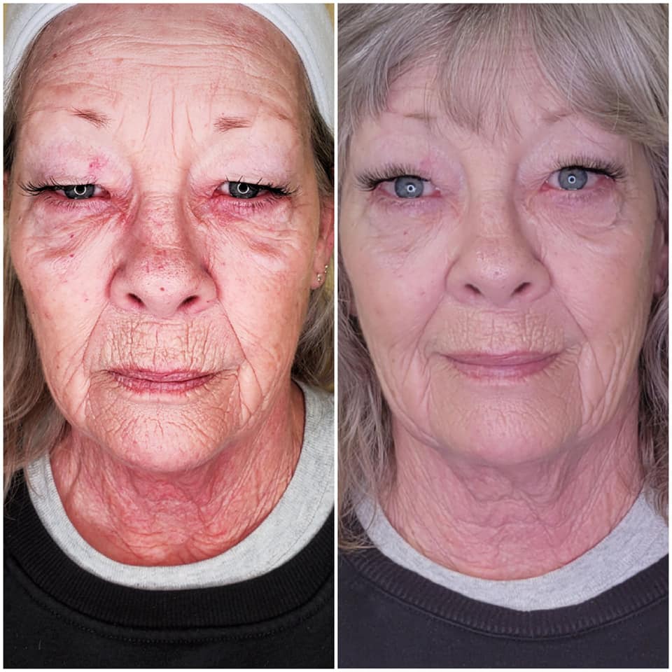 67e6a9d5b55041eff40a9f29_67da38769b55c3446f7cef8e_6-weeks-after-6th-cryofacial Body Sculpting - J.Bentley Hair Studio Day Spa