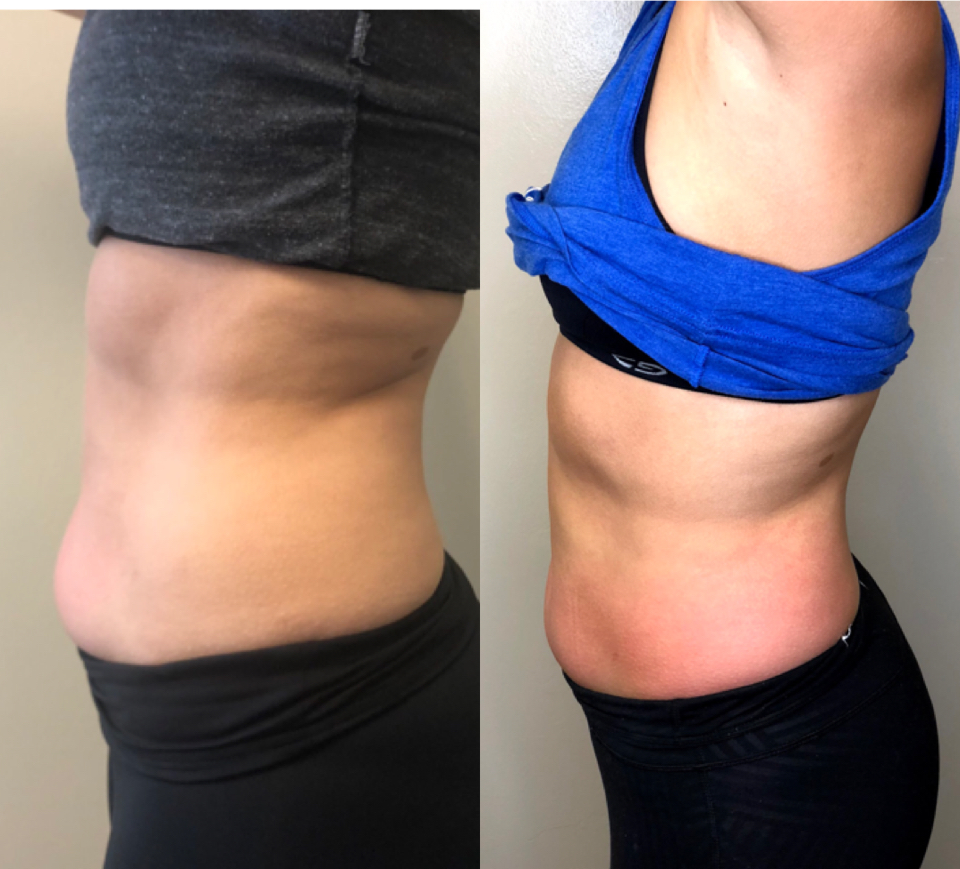 67e6a9d8cfe3f4192c3a47dd_67da386107b39ce6f15601d7_10-Shape Body Sculpting - J.Bentley Hair Studio Day Spa