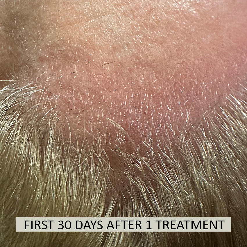 FOLIX%2030%20days Folix Hair Restoration - J.Bentley Hair Studio Day Spa