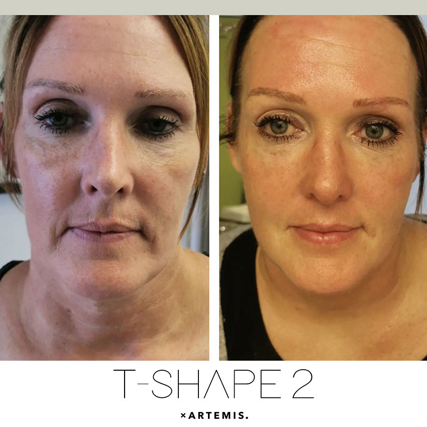 tshape-ba T-Shape - J.Bentley Hair Studio Day Spa
