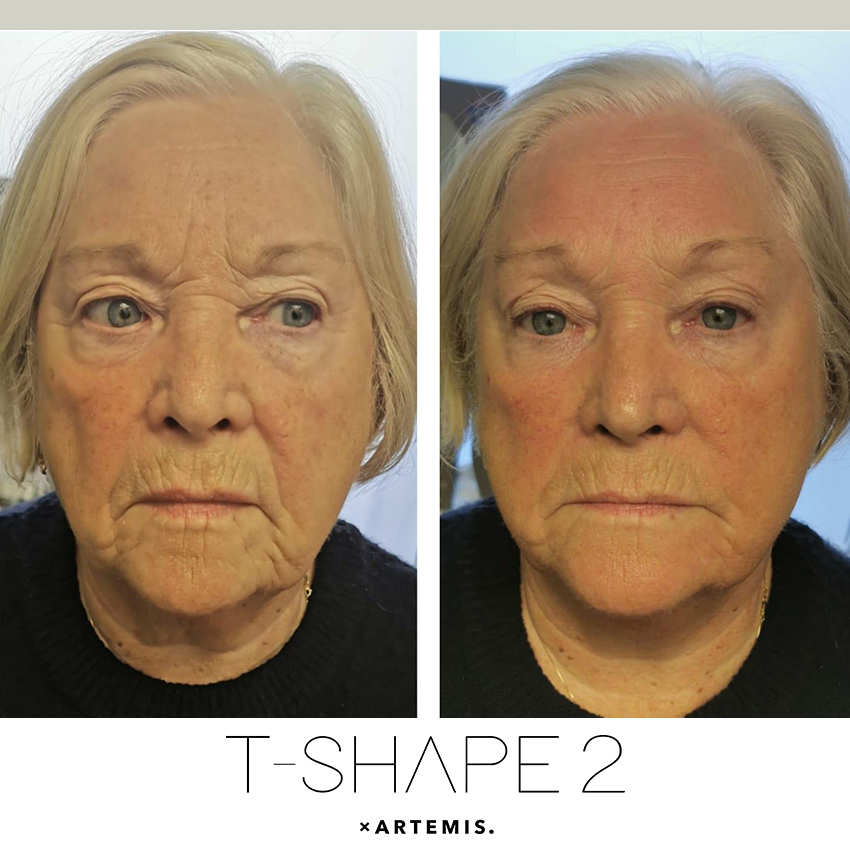 tshape-ba1 T-Shape - J.Bentley Hair Studio Day Spa