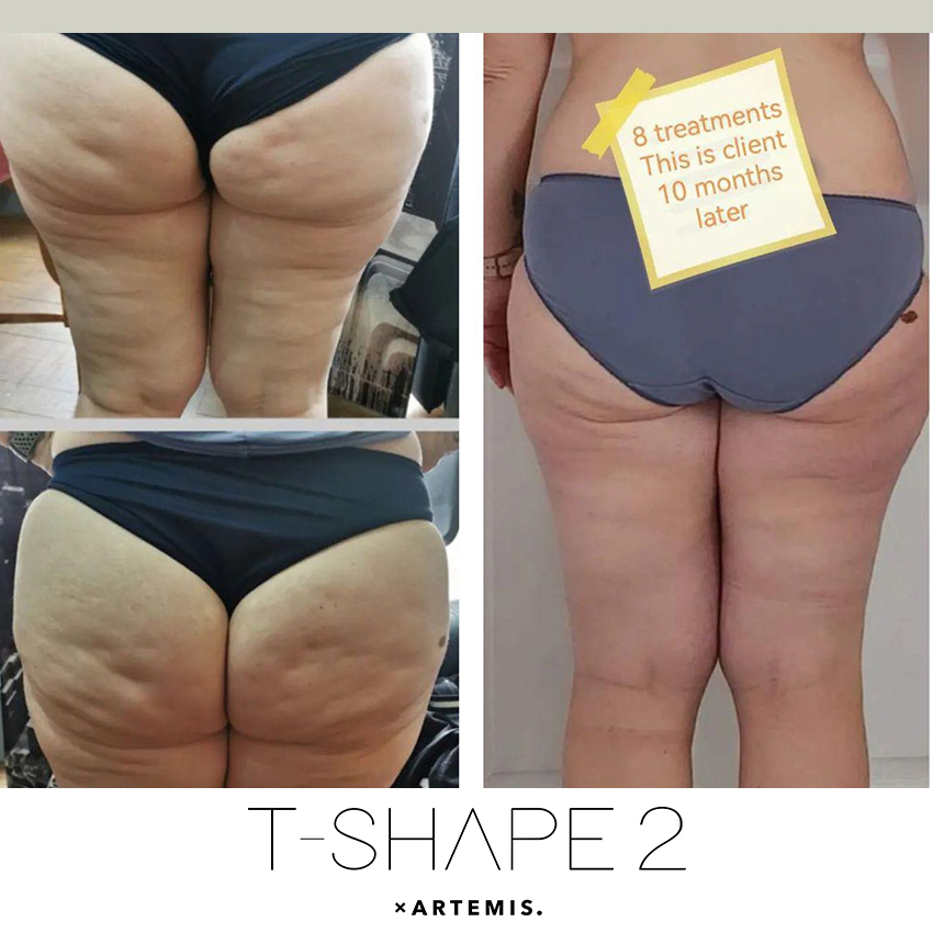 tshape-ba10 T-Shape - J.Bentley Hair Studio Day Spa
