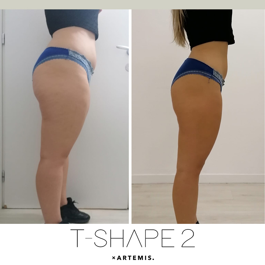 tshape-ba11 T-Shape - J.Bentley Hair Studio Day Spa