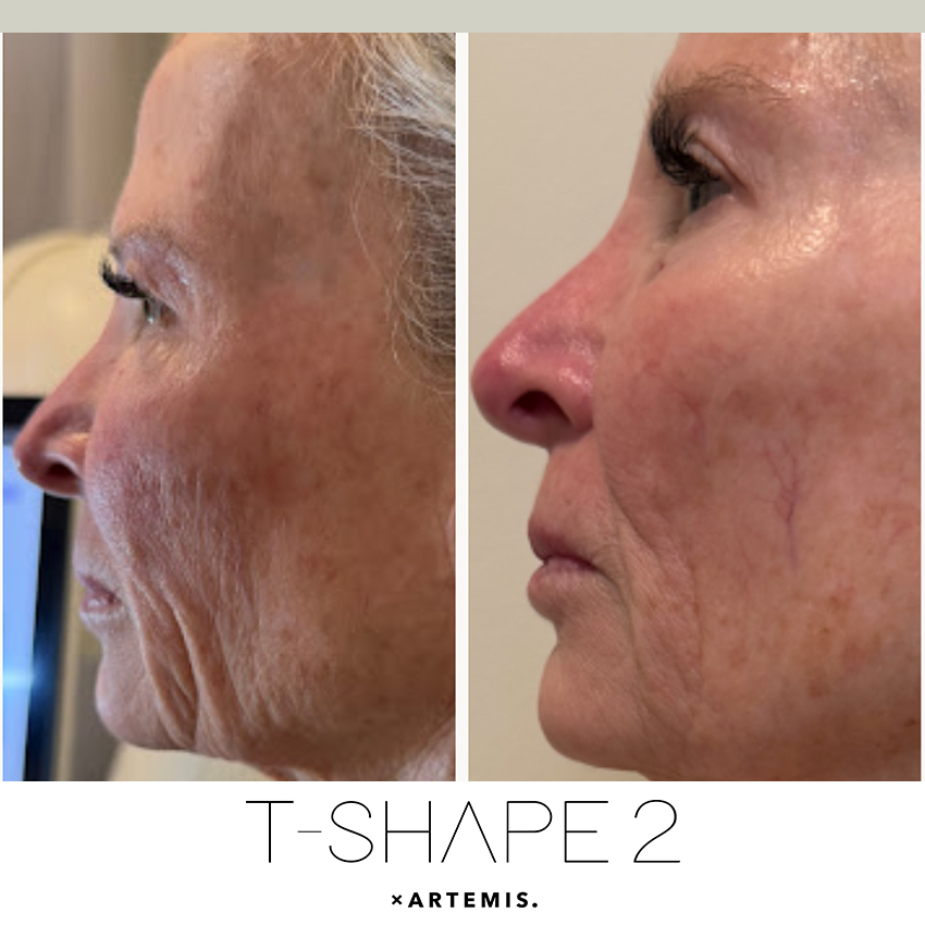 tshape-ba2 T-Shape - J.Bentley Hair Studio Day Spa