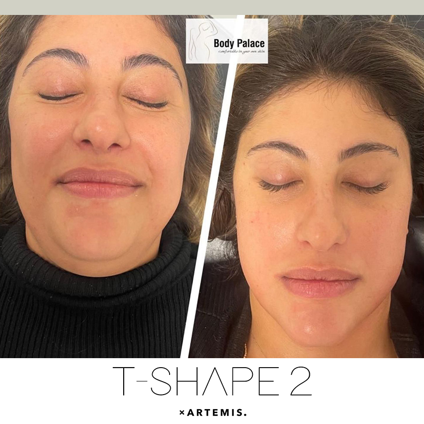 tshape-ba3 T-Shape - J.Bentley Hair Studio Day Spa