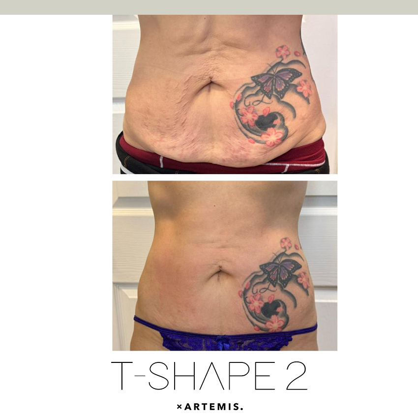 tshape-ba4 T-Shape - J.Bentley Hair Studio Day Spa