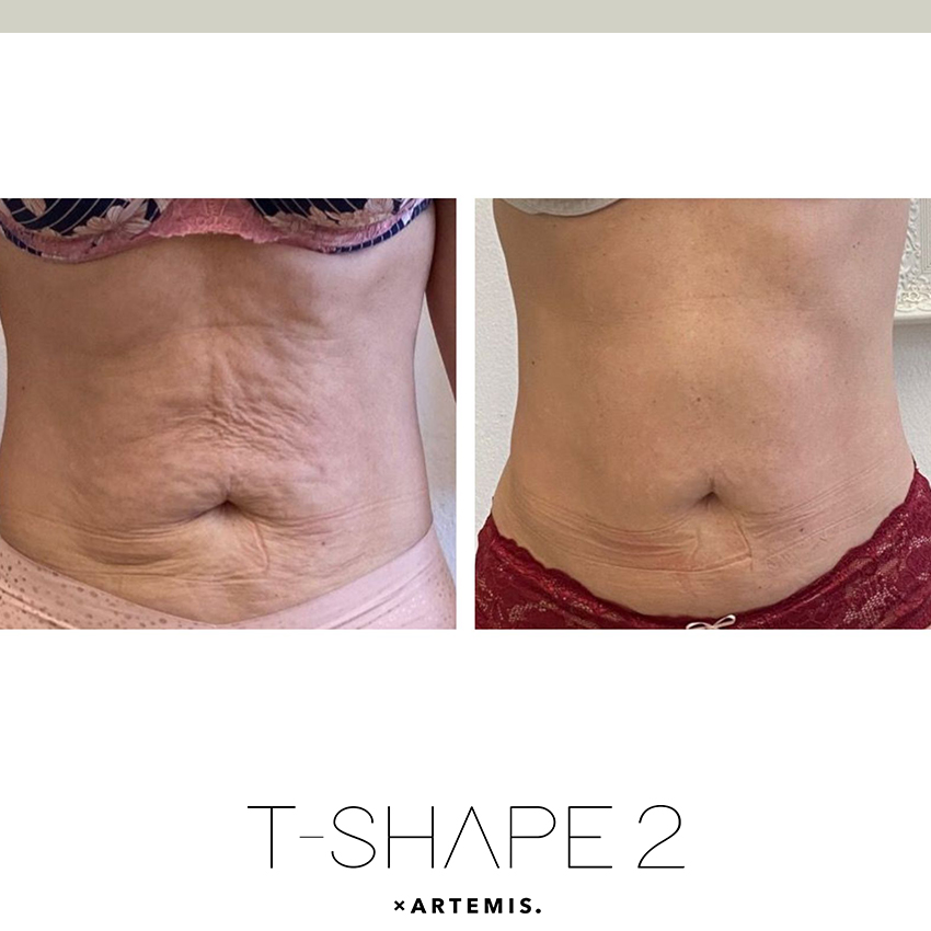 tshape-ba5 T-Shape - J.Bentley Hair Studio Day Spa