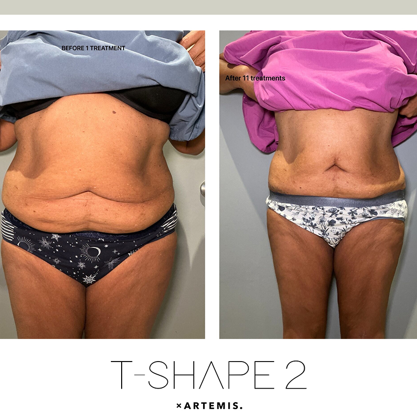 tshape-ba6 T-Shape - J.Bentley Hair Studio Day Spa