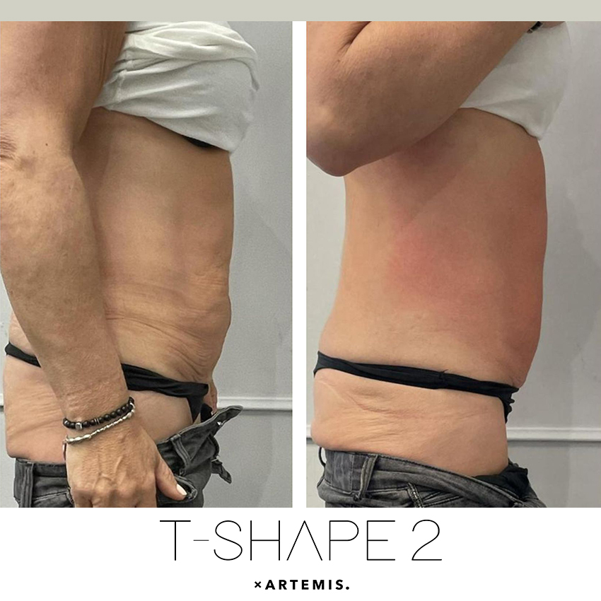 tshape-ba7 T-Shape - J.Bentley Hair Studio Day Spa