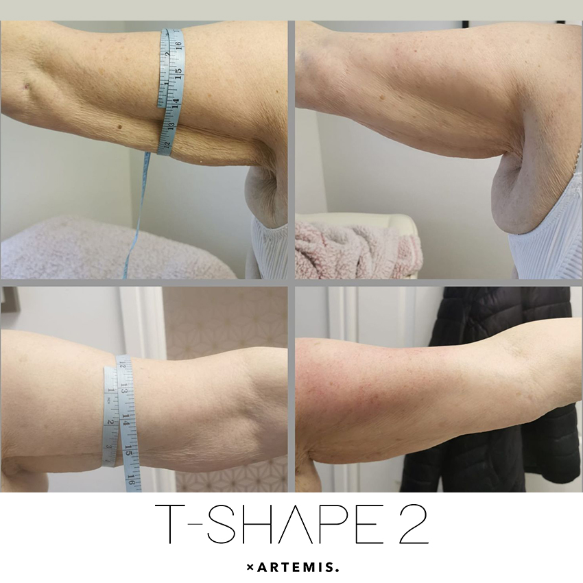 tshape-ba9 T-Shape - J.Bentley Hair Studio Day Spa