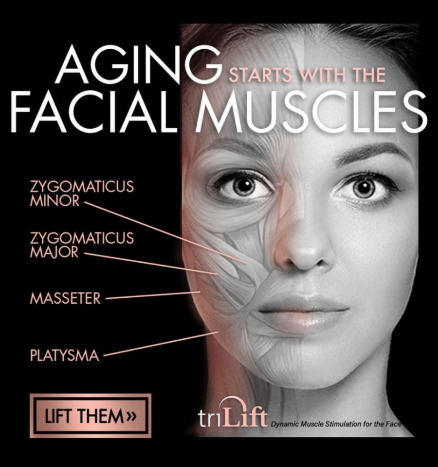 image-4-962x1024-c59b0365 Trilift Face Lift - J.Bentley Hair Studio Day Spa