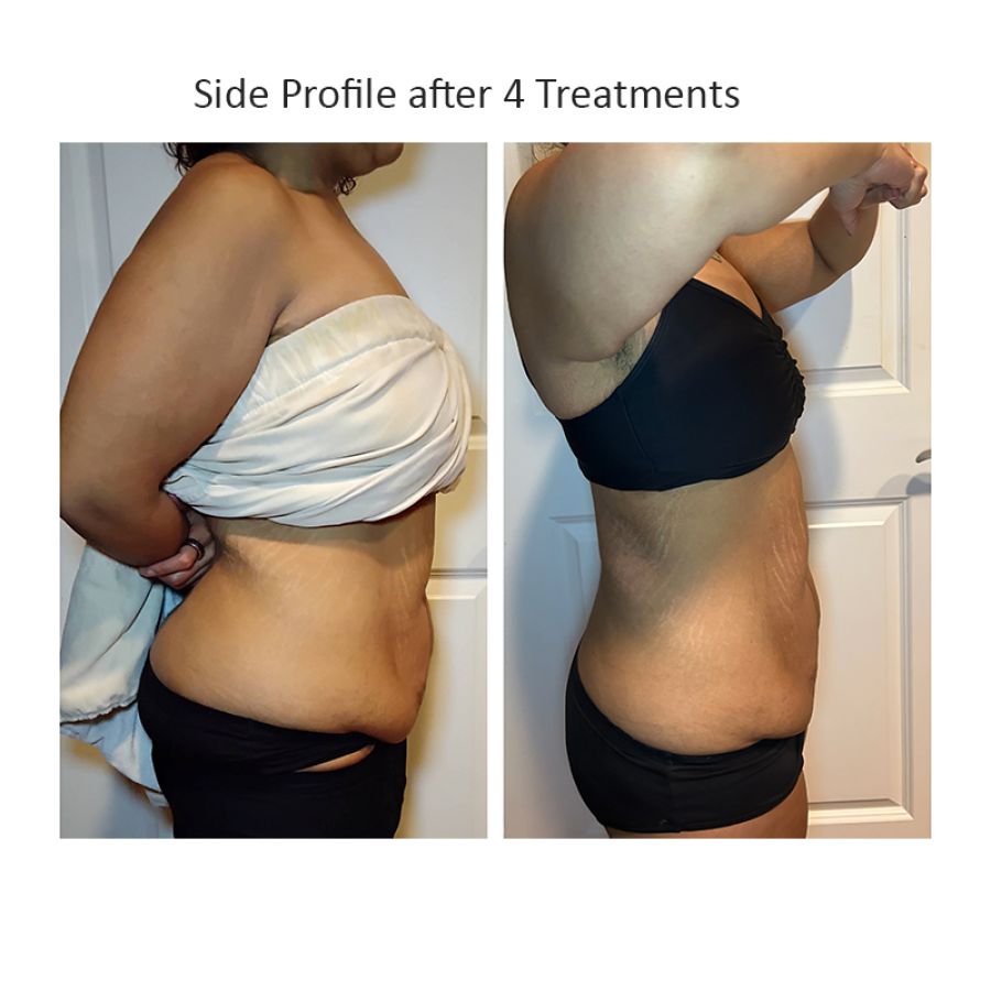 tshape_tori%20side-0582ec71 Current Promotions - J.Bentley Hair Studio Day Spa | Powell, OH