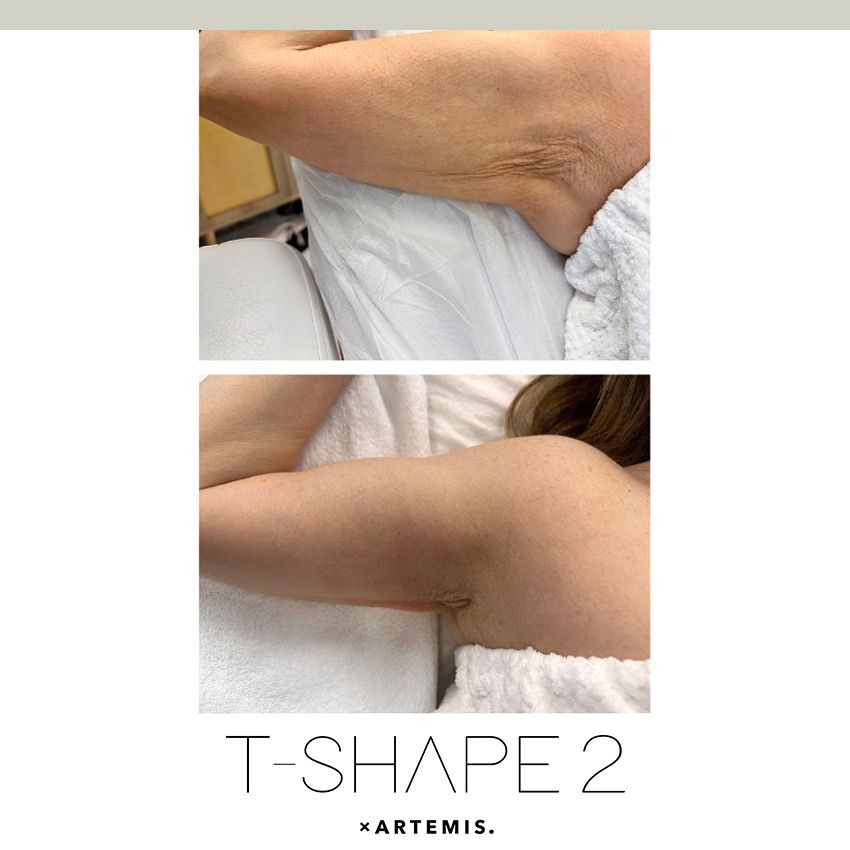 tshape-ba8-60079819 T-Shape - J.Bentley Hair Studio Day Spa | Powell, OH