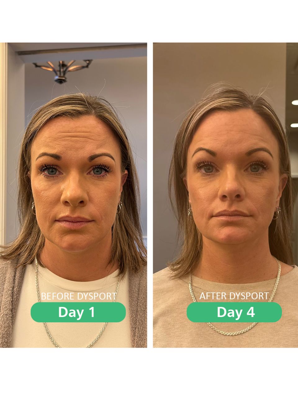 DYSPORT_HERO%20TONYA-ed655319 Home - J.Bentley Hair Studio Day Spa | Powell, OH