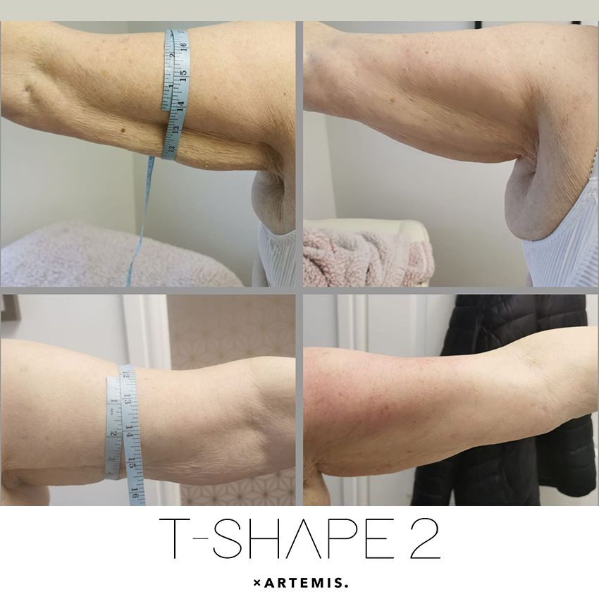 tshape-ba9-fe795805 T-Shape - J.Bentley Hair Studio Day Spa | Powell, OH